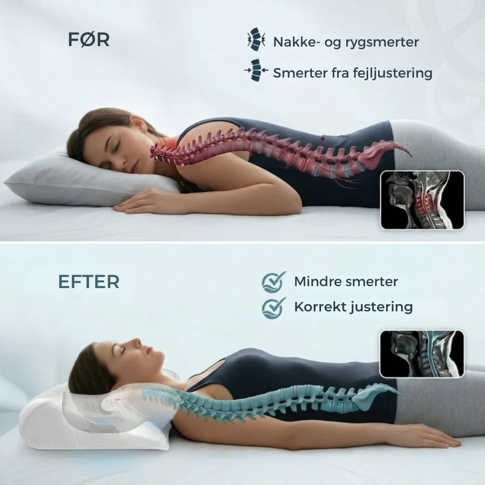 NordStöd Kudde™ - Optimal Nackstöd för En God Natts Sömn